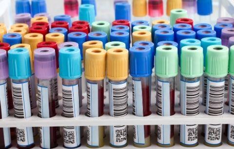 How To Improve Medical Screening With Color-Coding Labels