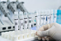 The Label Material Behind a Clinic Testing Workflow